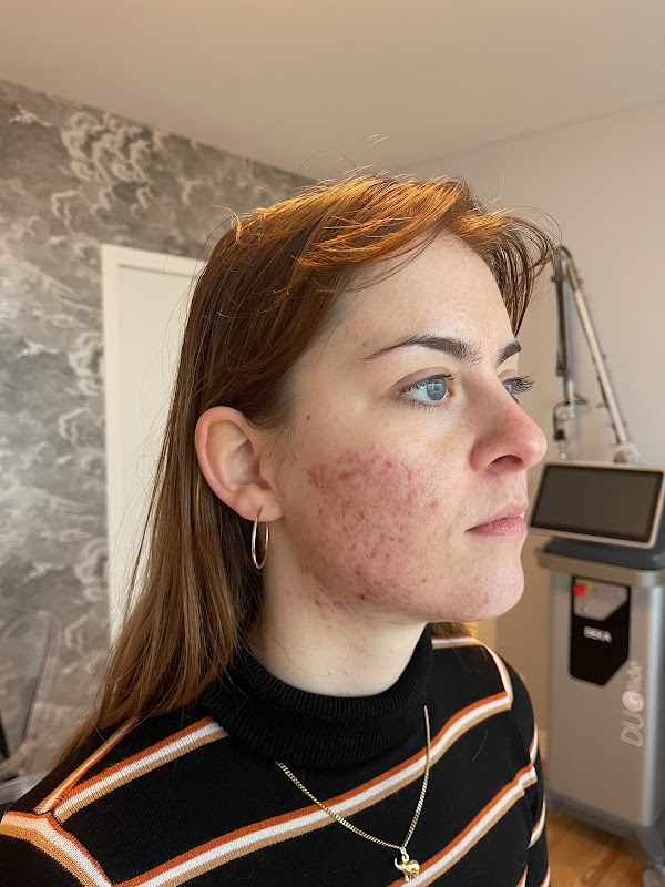 Résidence Bellevue - Photo 3 sur 5 - Chambres et hébergement